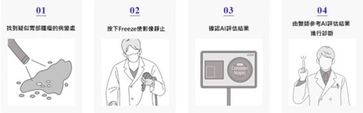 内視鏡圖像診斷輔助軟體gastroAI-model步驟示意圖