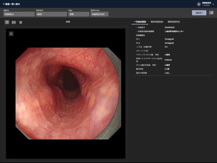 胃部內視鏡影像